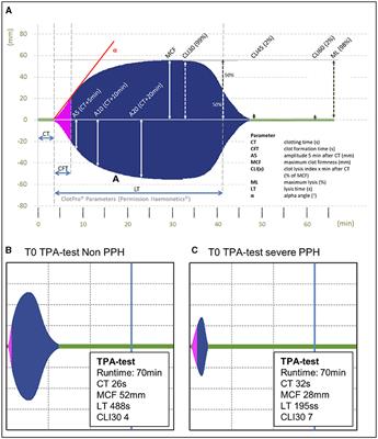 Fibrinolytic potential as a risk factor for postpartum hemorrhage